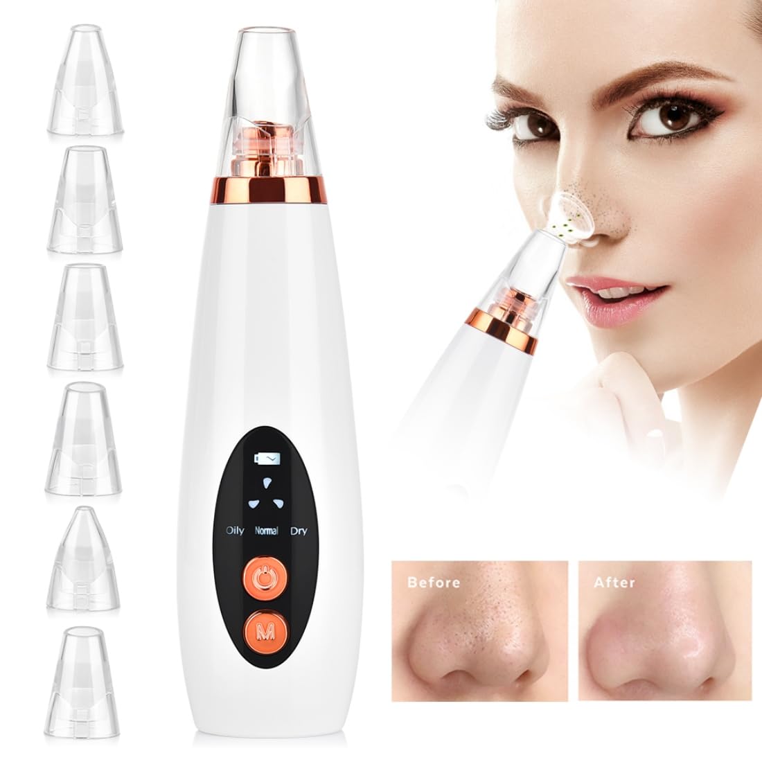 Fluent 6-in-1 Blackhead Remover & Facial Pore Cleaner – Multifunction Vacuum Extractor for Men & Women