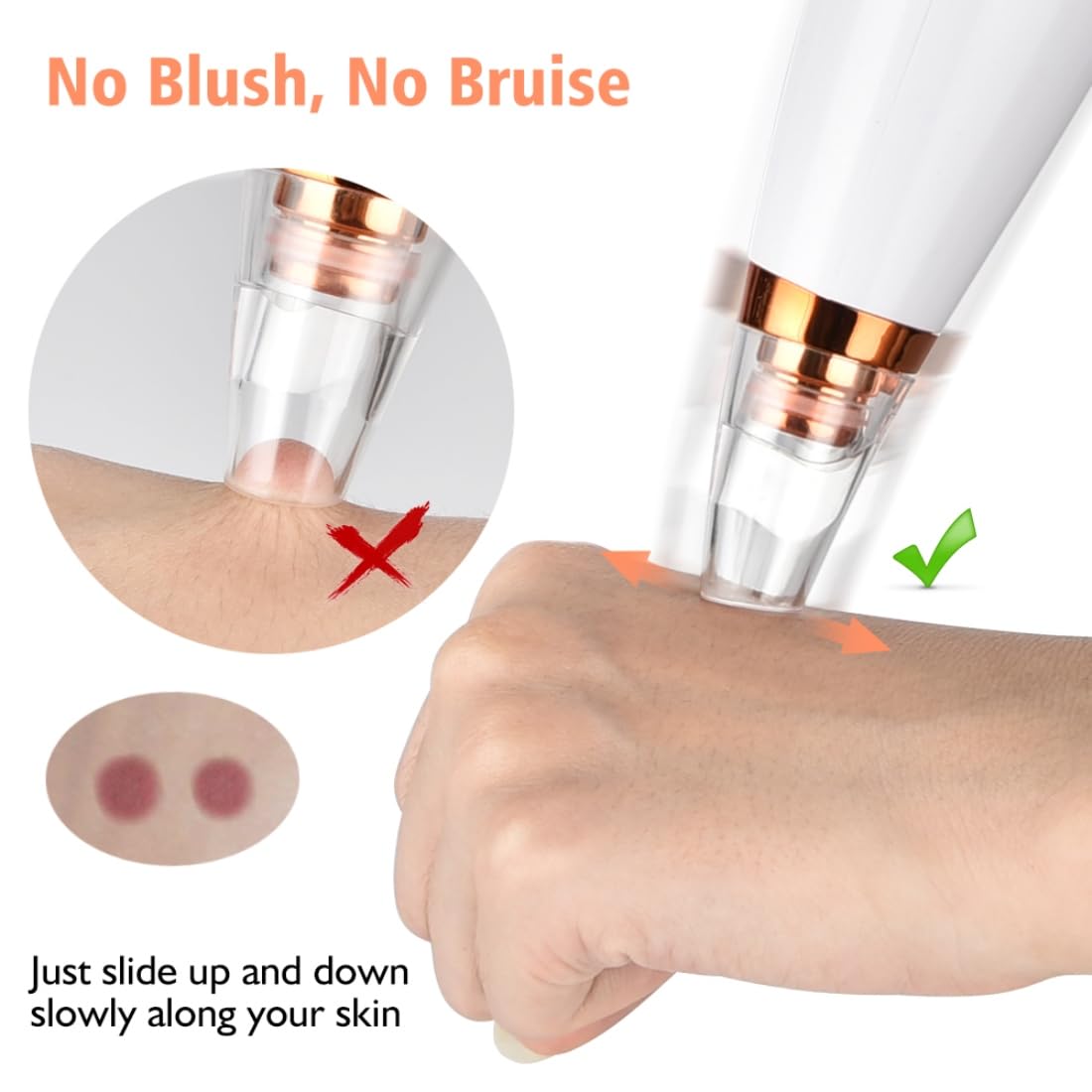 Fluent 6-in-1 Blackhead Remover & Facial Pore Cleaner – Multifunction Vacuum Extractor for Men & Women