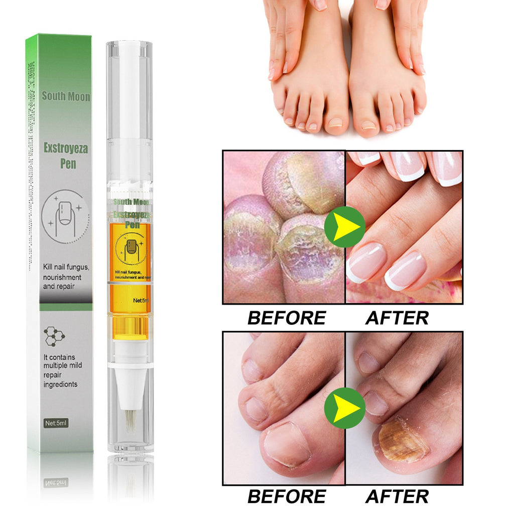 Nail Fungus Repair Pen – Heals & Restores Nails