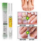 Nail Fungus Repair Pen – Heals & Restores Nails