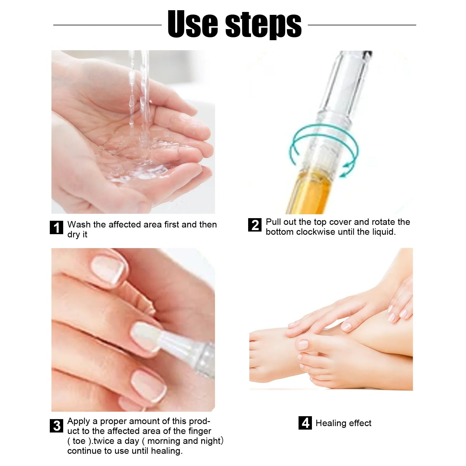 Nail Fungus Repair Pen – Heals & Restores Nails