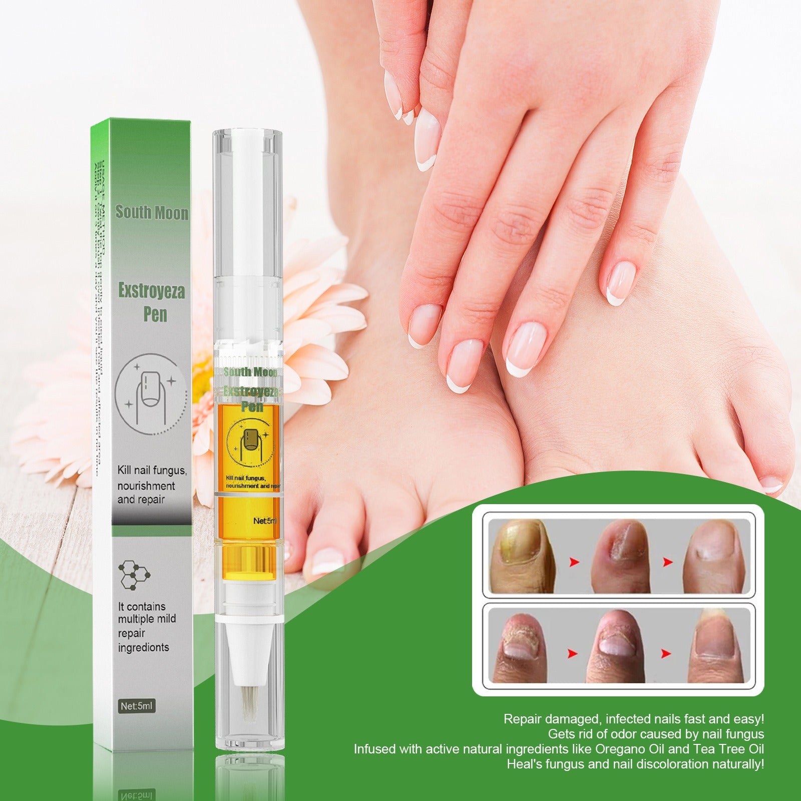 Nail Fungus Repair Pen – Heals & Restores Nails